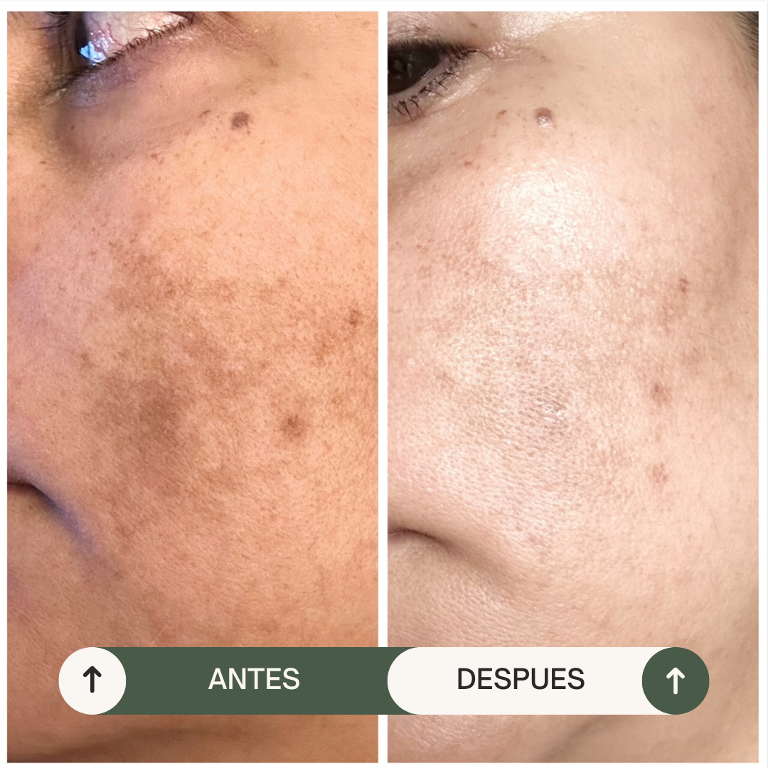 JABÓN ANTI-MANCHAS ARROZ