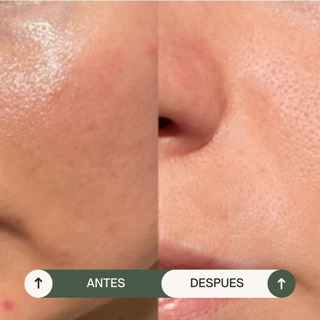 JABÓN CONTROL-GRASA HAMAMELIS